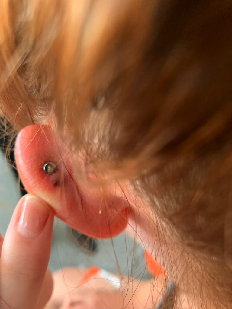 travel story, Travel Story: That One Time I Had Surgery in Vietnam on my Ear
